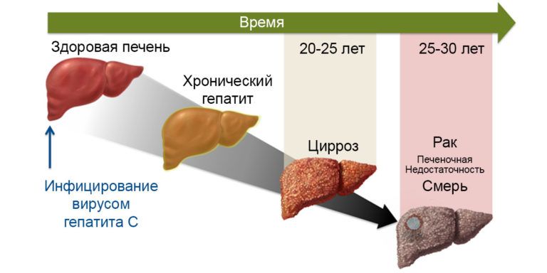 гепатит-3.jpg